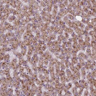 Immunohistochemistry-Paraffin: AMMECR1 Antibody [NBP2-55138]