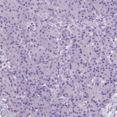 Immunohistochemistry-Paraffin: AMMECR1 Antibody [NBP2-55138]