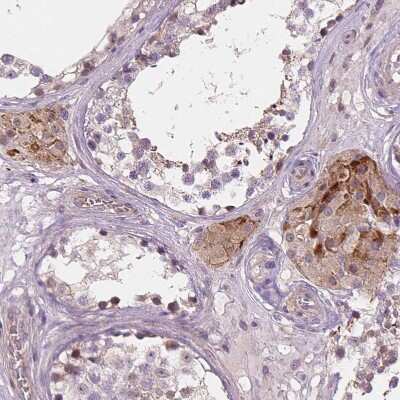 Immunohistochemistry-Paraffin: AMMECR1 Antibody [NBP2-55138]