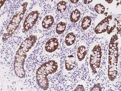 Immunohistochemistry-Paraffin: AMMECR1 Antibody [NBP2-97342]