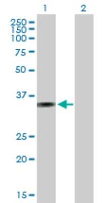 Western Blot: AMMECR1 Antibody [H00009949-B01P]