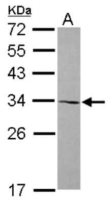 Western Blot: AMMECR1 Antibody [NBP2-15377]