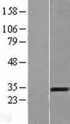 Western Blot: AMMECR1 Overexpression Lysate [NBL1-07503]