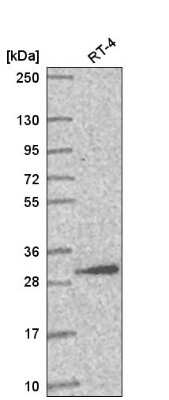 Western Blot: AMMECR1L Antibody [NBP2-58193]