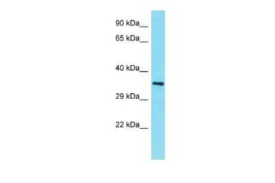 Western Blot: AMMECR1L Antibody [NBP2-82592]