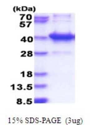 SDS-PAGE: Recombinant Human AMMECR1L His Protein [NBP2-51779]