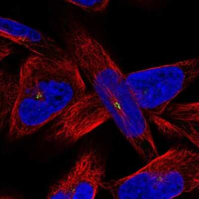 Immunocytochemistry/ Immunofluorescence: AMN1 Antibody [NBP2-56554]