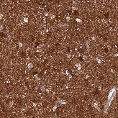 Immunohistochemistry-Paraffin: AMN1 Antibody [NBP1-91663]