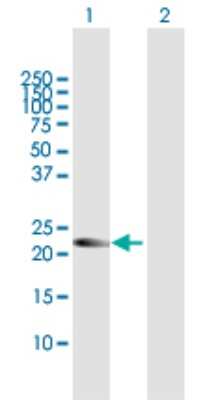 Western Blot: AMN1 Antibody [H00196394-B01P]