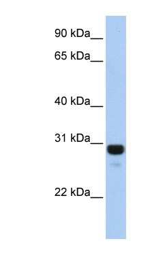 Western Blot: AMN1 Antibody [NBP1-56931]