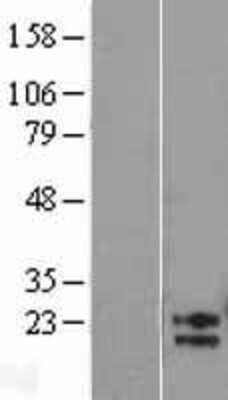 Western Blot: AMN1 Overexpression Lysate [NBL1-07504]