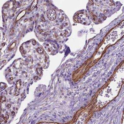 Immunohistochemistry-Paraffin: AMOT Antibody [NBP2-49513]