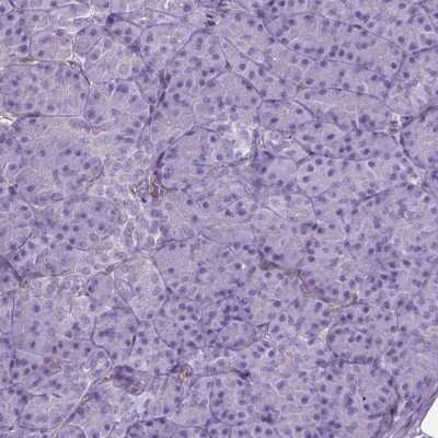 Immunohistochemistry-Paraffin: AMOT Antibody [NBP2-49513]