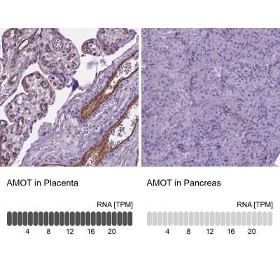 Immunohistochemistry-Paraffin: AMOT Antibody [NBP2-49513]