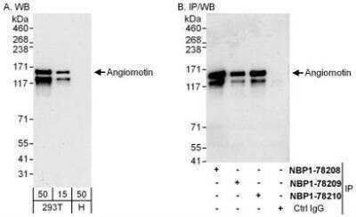 Western Blot: AMOT Antibody [NBP1-78208]