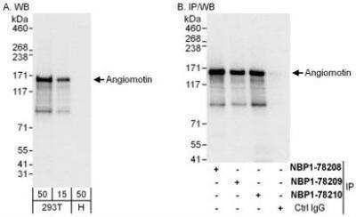 Western Blot: AMOT Antibody [NBP1-78210]