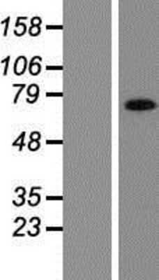 Western Blot: AMOT Overexpression Lysate [NBP2-05714]
