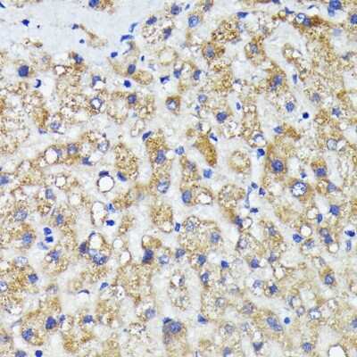 Immunohistochemistry-Paraffin: AMOTL2 Antibody - Azide and BSA Free [NBP2-92875]