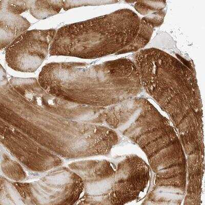 Immunohistochemistry-Paraffin: AMPD1 Antibody [NBP1-81269]