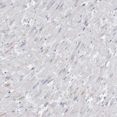 Immunohistochemistry-Paraffin: AMPD1 Antibody [NBP1-81269]