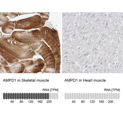 Immunohistochemistry-Paraffin: AMPD1 Antibody [NBP1-81269]