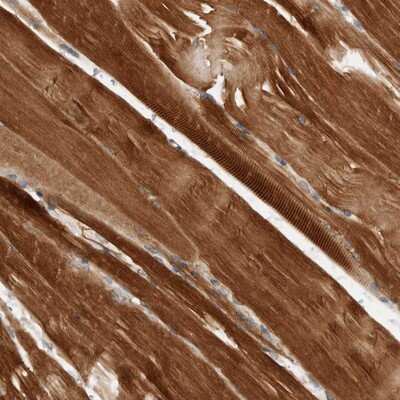 Immunohistochemistry-Paraffin: AMPD1 Antibody [NBP1-81270]