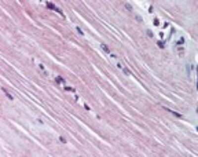 Immunohistochemistry-Paraffin: AMPD1 Antibody [NBP2-24509]