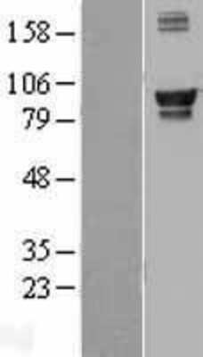 Western Blot: AMPD1 Overexpression Lysate [NBL1-07505]