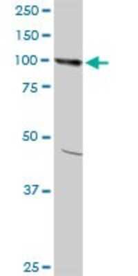 Western Blot: AMPD2 Antibody (6A8) [H00000271-M09]
