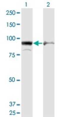 Western Blot: AMPD2 Antibody (6A8) [H00000271-M09]