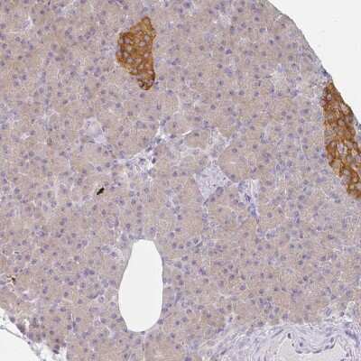 Immunohistochemistry: AMPD2 Antibody [NBP2-48971]