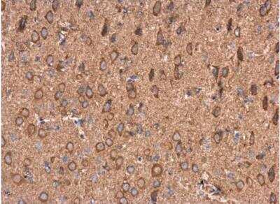 Immunohistochemistry-Paraffin: AMPD2 Antibody [NBP1-33698]