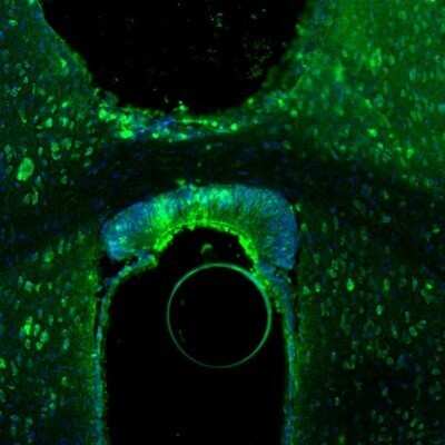 Immunohistochemistry-Paraffin: AMPD2 Antibody [NBP2-47549]