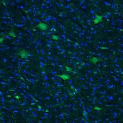 Immunohistochemistry-Paraffin: AMPD2 Antibody [NBP2-47549]
