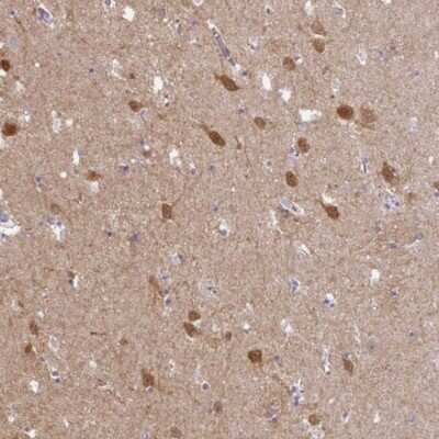 Immunohistochemistry-Paraffin: AMPD2 Antibody [NBP2-47549]