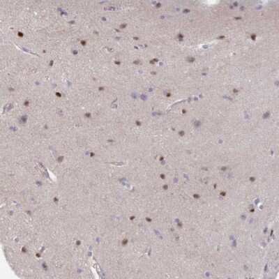 Immunohistochemistry-Paraffin: AMPD2 Antibody [NBP2-47549]
