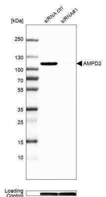 Western Blot: AMPD2 Antibody [NBP2-47549]