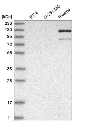 Western Blot: AMPD2 Antibody [NBP2-48578]