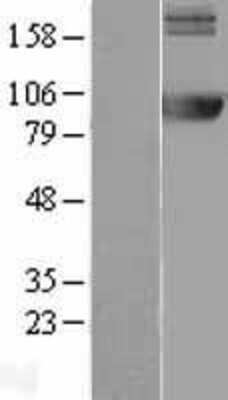 Western Blot: AMPD2 Overexpression Lysate [NBL1-07506]