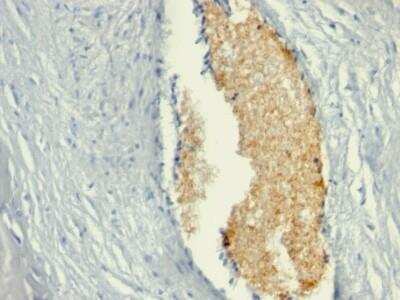 Immunohistochemistry-Paraffin: AMPD3 Antibody (AMPD3/901) - Azide and BSA Free [NBP2-47691]