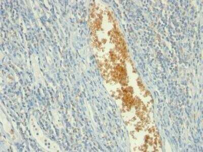 Immunohistochemistry-Paraffin: AMPD3 Antibody (AMPD3/901) - Azide and BSA Free [NBP2-47691]