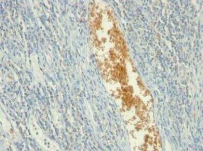 Immunohistochemistry-Paraffin: AMPD3 Antibody (AMPD3/901) - IHC-Prediluted [NBP2-48158]