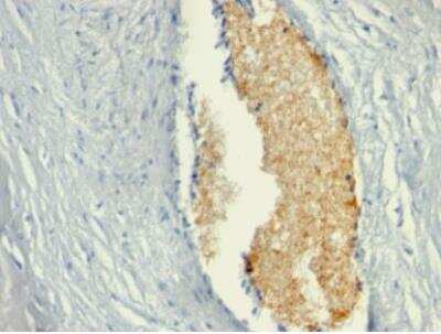 Immunohistochemistry-Paraffin: AMPD3 Antibody (AMPD3/901) - IHC-Prediluted [NBP2-48158]