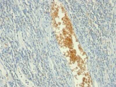 Immunohistochemistry-Paraffin: AMPD3 Antibody (AMPD3/901) [NBP2-44441]