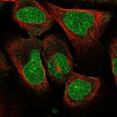 Immunocytochemistry/ Immunofluorescence: AMPD3 Antibody [NBP2-14290]