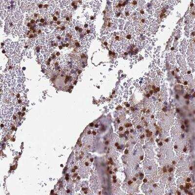 Immunohistochemistry-Paraffin: AMPD3 Antibody [NBP2-14290]