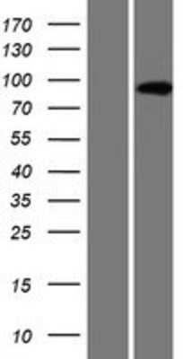 Western Blot: AMPD3 Overexpression Lysate [NBP2-08635]