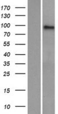 Western Blot: AMPD3 Overexpression Lysate [NBP2-09021]