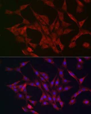 Immunocytochemistry/ Immunofluorescence: AMPK alpha 1/2 Antibody - Azide and BSA Free [NBP3-05628]