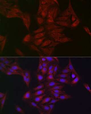 Immunocytochemistry/ Immunofluorescence: AMPK alpha 1/2 Antibody - Azide and BSA Free [NBP3-05628]